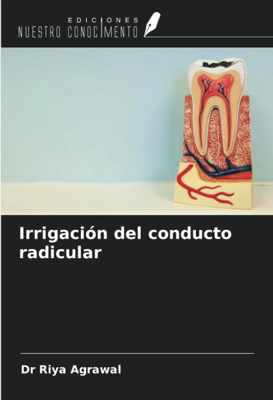 Irrigación del conducto radicular
