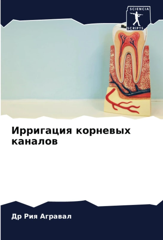 Ирригация корневых каналов