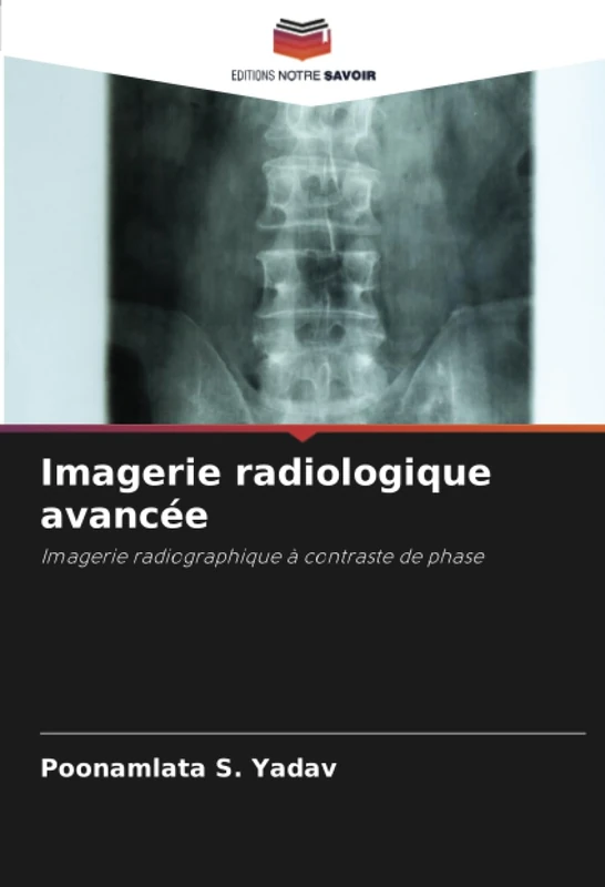 Imagerie radiologique avancée: Imagerie radiographique à contraste de phase - Image 1