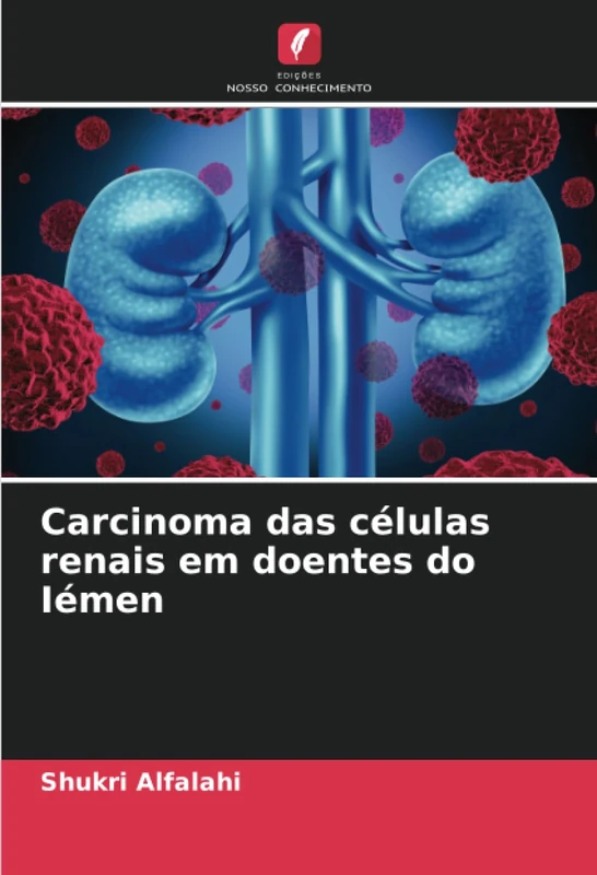 Carcinoma das células renais em doentes do Iémen