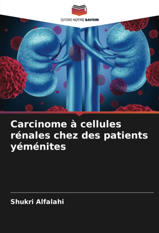 Carcinome à cellules rénales chez des patients yéménites