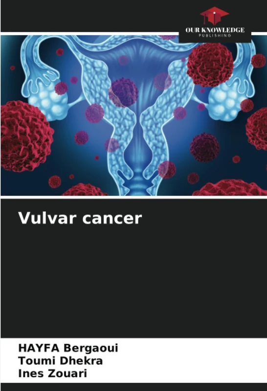 Vulvar cancer