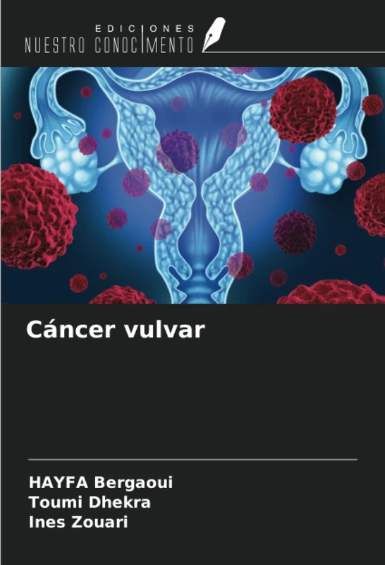 Cáncer vulvar