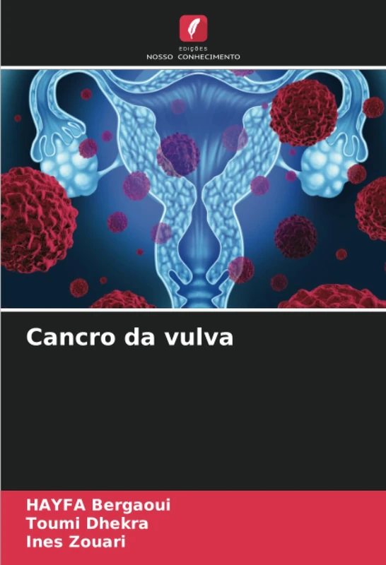 Cancro da vulva
