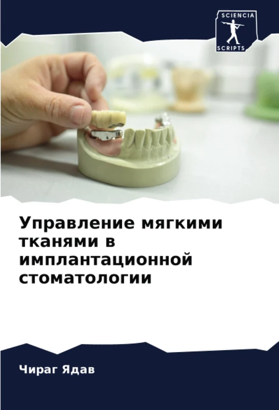 Управление мягкими тканями в имплантационной стоматологии