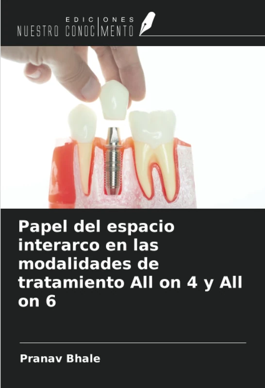 Papel del espacio interarco en las modalidades de tratamiento All on 4 y All on 6 - Image 1