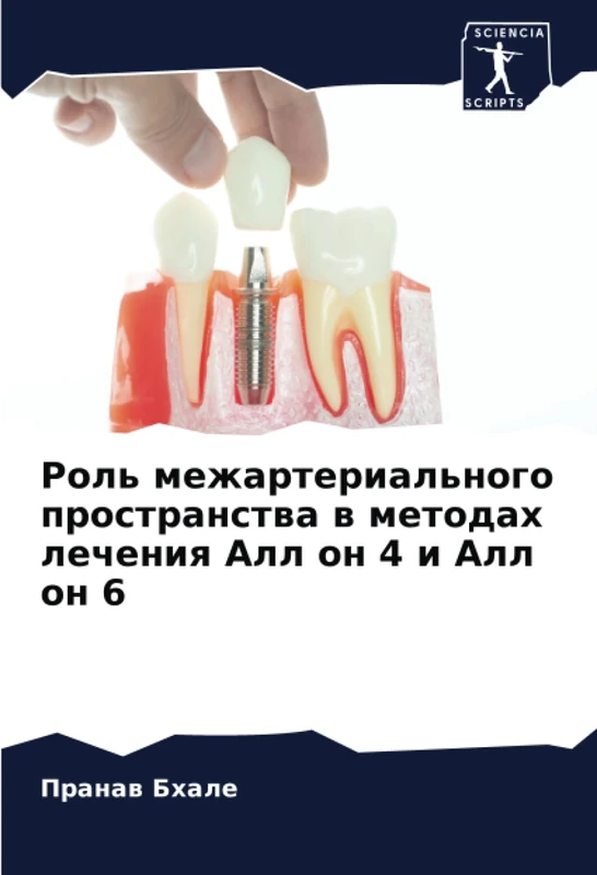 Роль межартериального пространства в методах лечения Алл он 4 и Алл он 6