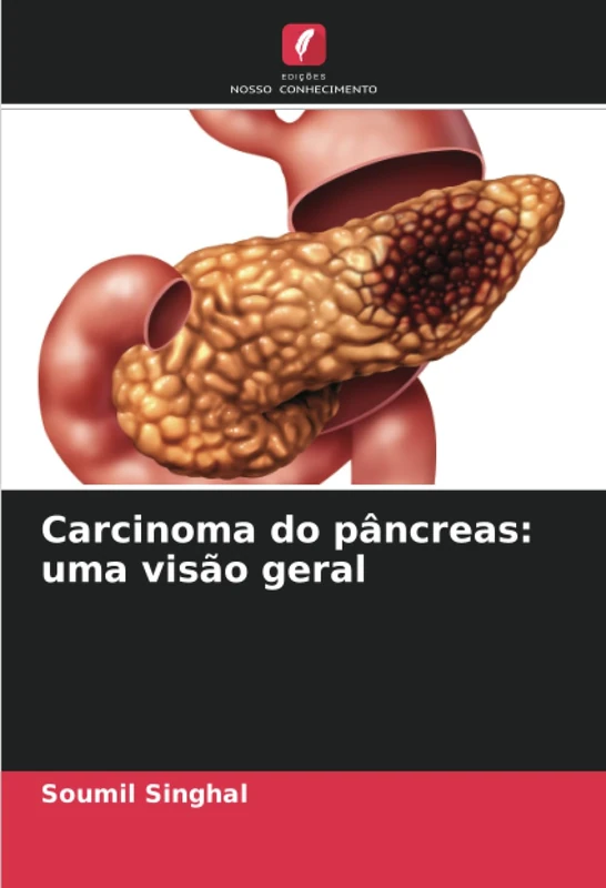 Carcinoma do pâncreas: uma visão geral