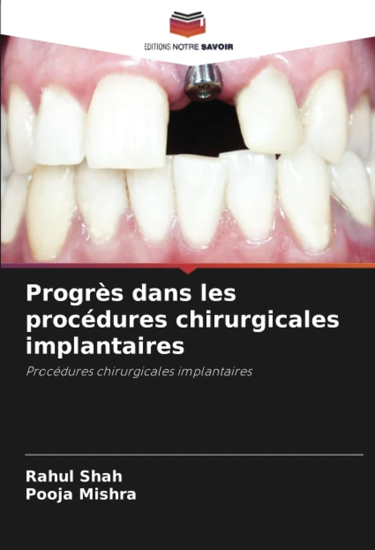 Progrès dans les procédures chirurgicales implantaires: Procédures chirurgicales implantaires