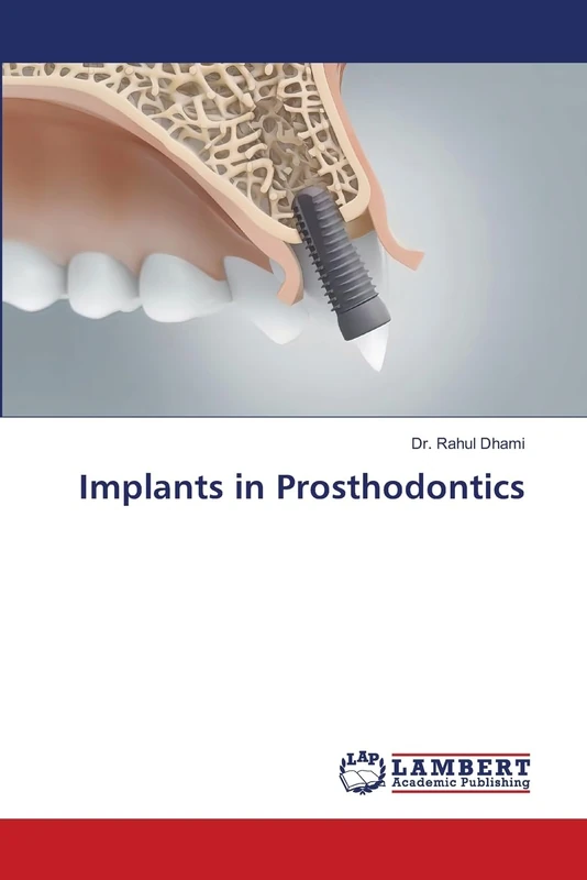 Implants in Prosthodontics