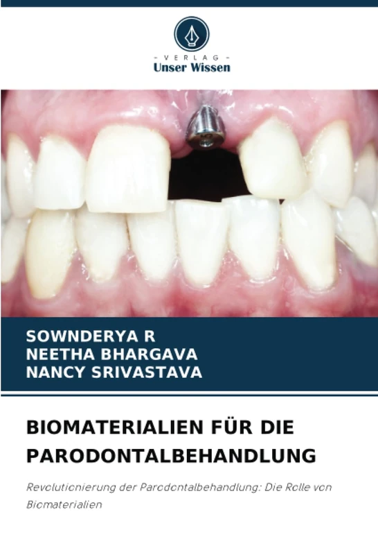 BIOMATERIALIEN FÜR DIE PARODONTALBEHANDLUNG: Revolutionierung der Parodontalbehandlung: Die Rolle von Biomaterialien