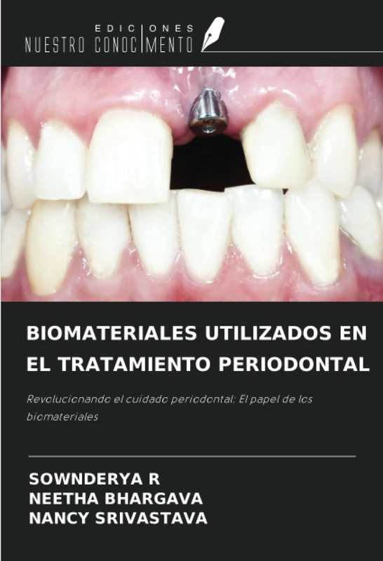 BIOMATERIALES UTILIZADOS EN EL TRATAMIENTO PERIODONTAL: Revolucionando el cuidado periodontal: El papel de los biomateriales