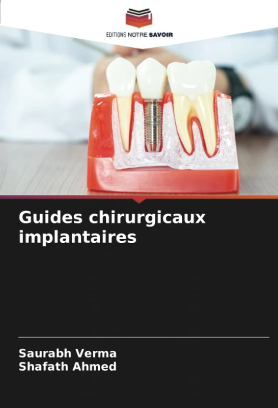 Guides chirurgicaux implantaires