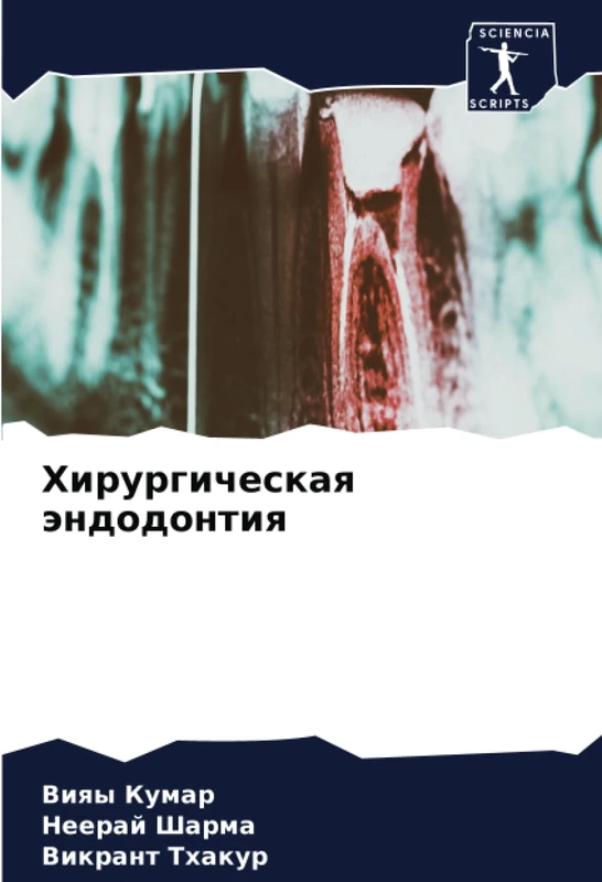 Хирургическая эндодонтия