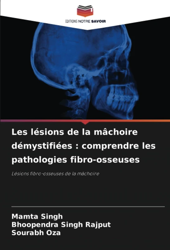 Les lésions de la mâchoire démystifiées : comprendre les pathologies fibro-osseuses: Lésions fibro-osseuses de la mâchoire