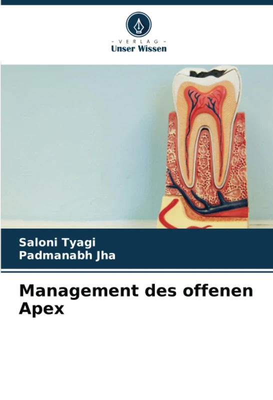 Management des offenen Apex