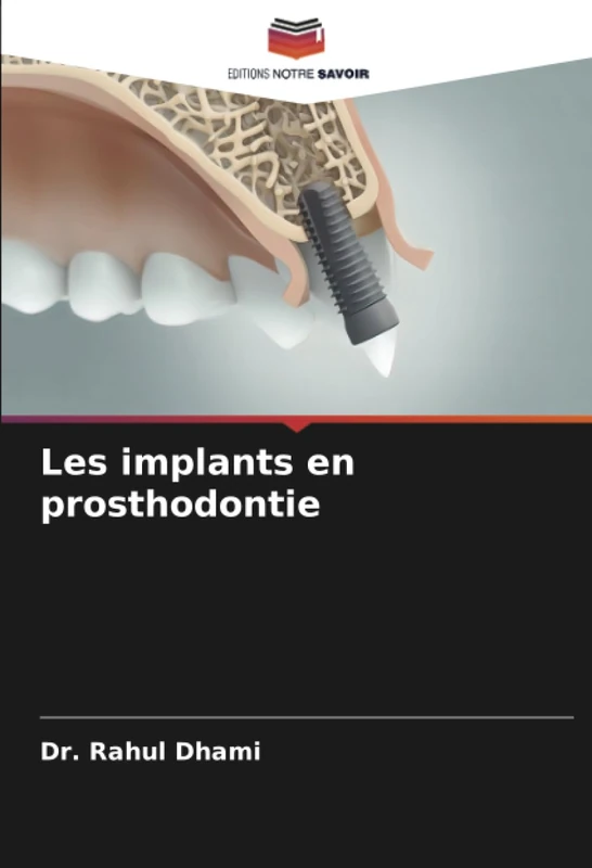Les implants en prosthodontie
