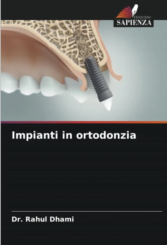 Impianti in ortodonzia