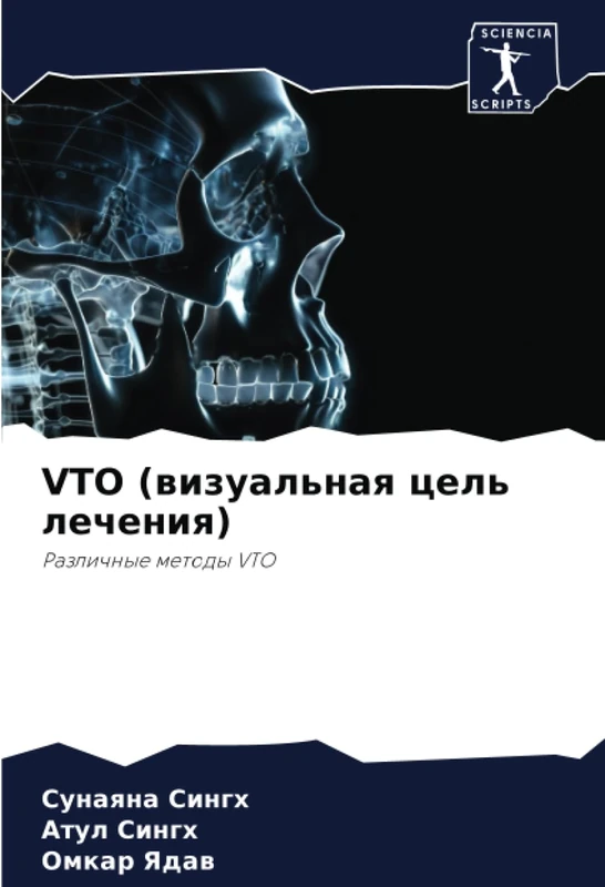VTO (визуальная цель лечения): Различные методы VTO: Razlichnye metody VTO