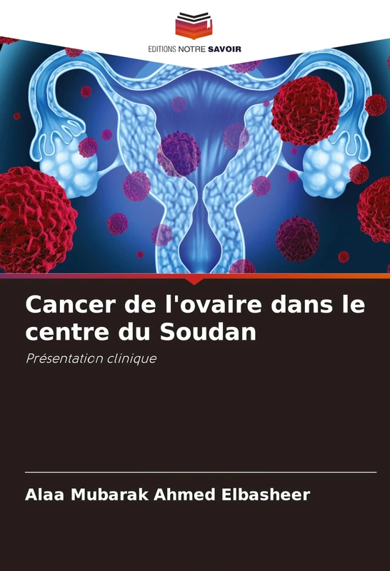Cancer de l'ovaire dans le centre du Soudan: Présentation clinique