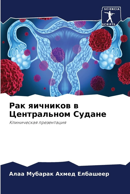Рак яичников в Центральном Судане: Klinicheskaq prezentaciq
