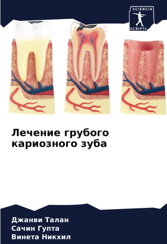 Лечение грубого кариозного зуба