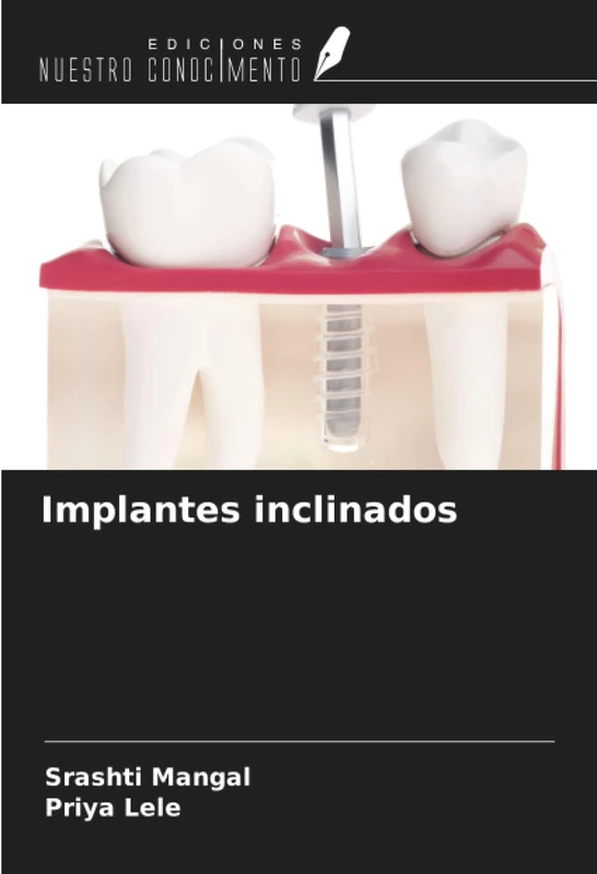Implantes inclinados