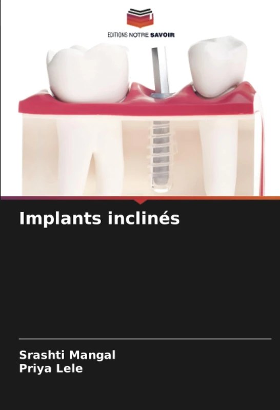 Implants inclinés