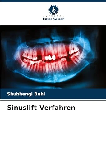 Sinuslift-Verfahren