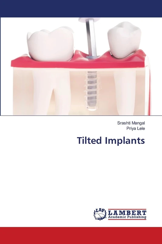 Tilted Implants