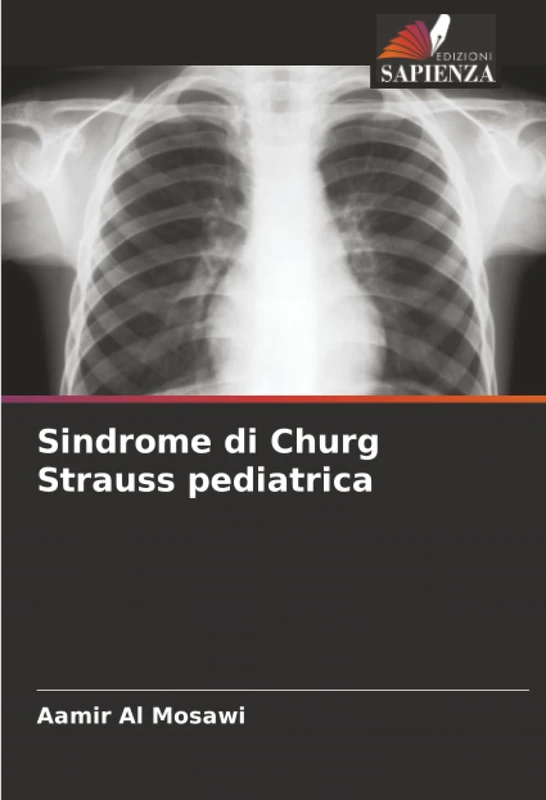 Sindrome di Churg Strauss pediatrica