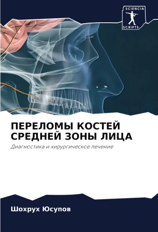 ПЕРЕЛОМЫ КОСТЕЙ СРЕДНЕЙ ЗОНЫ ЛИЦА: Диагностика и хирургическое лечение: Diagnostika i hirurgicheskoe lechenie