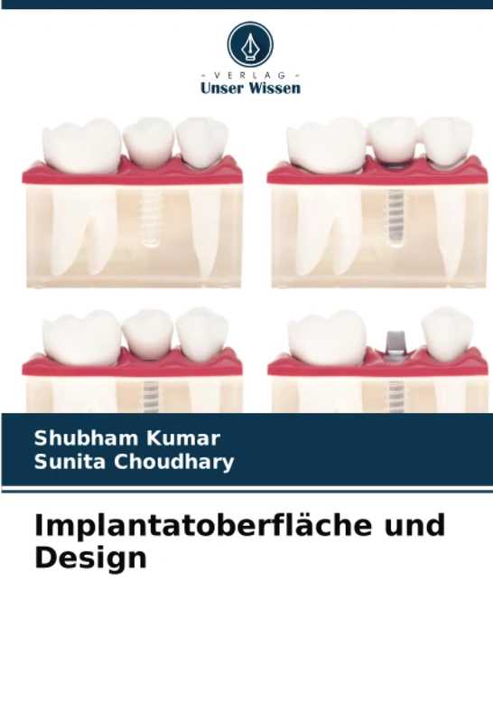 Implantatoberfläche und Design
