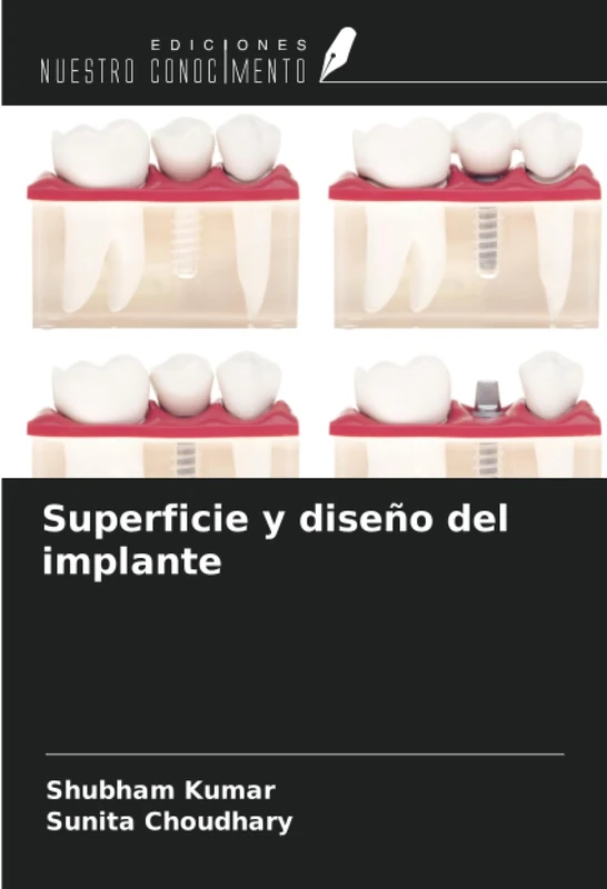 Superficie y diseño del implante
