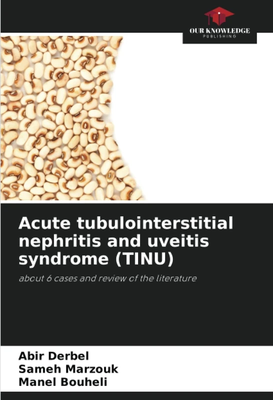 Acute tubulointerstitial nephritis and uveitis syndrome (TINU): about 6 cases and review of the literature - Image 1
