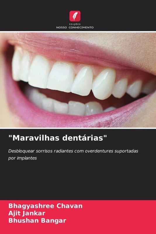 "Maravilhas dentárias": Desbloquear sorrisos radiantes com overdentures suportadas por implantes