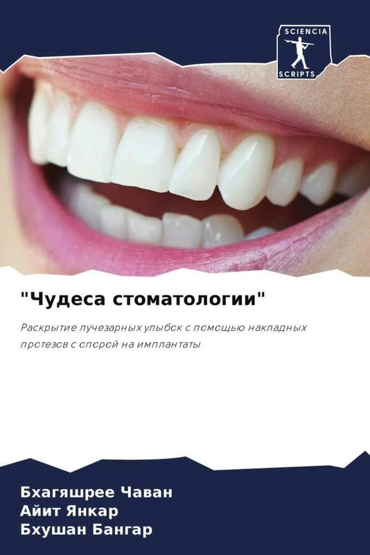 "Чудеса стоматологии": Раскрытие лучезарных улыбок с помощью накладных протезов с опорой на имплантаты: Raskrytie luchezarnyh ulybok s pomosch'ü nakladnyh protezow s oporoj na implantaty