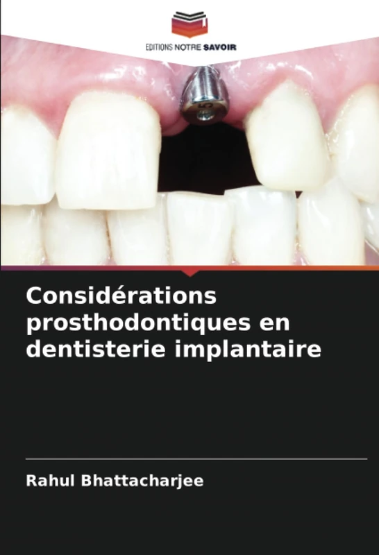 Considérations prosthodontiques en dentisterie implantaire