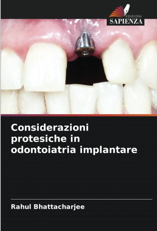 Considerazioni protesiche in odontoiatria implantare