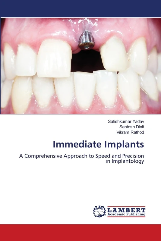 Immediate Implants: A Comprehensive Approach to Speed and Precision in Implantology