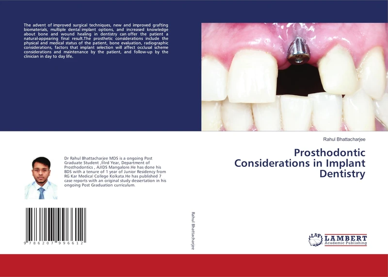 Prosthodontic Considerations in Implant Dentistry
