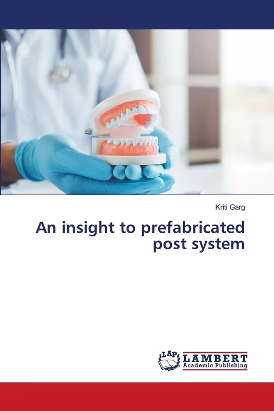 An insight to prefabricated post system - Image 1