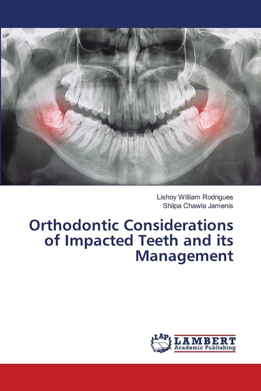 Orthodontic Considerations of Impacted Teeth and its Management