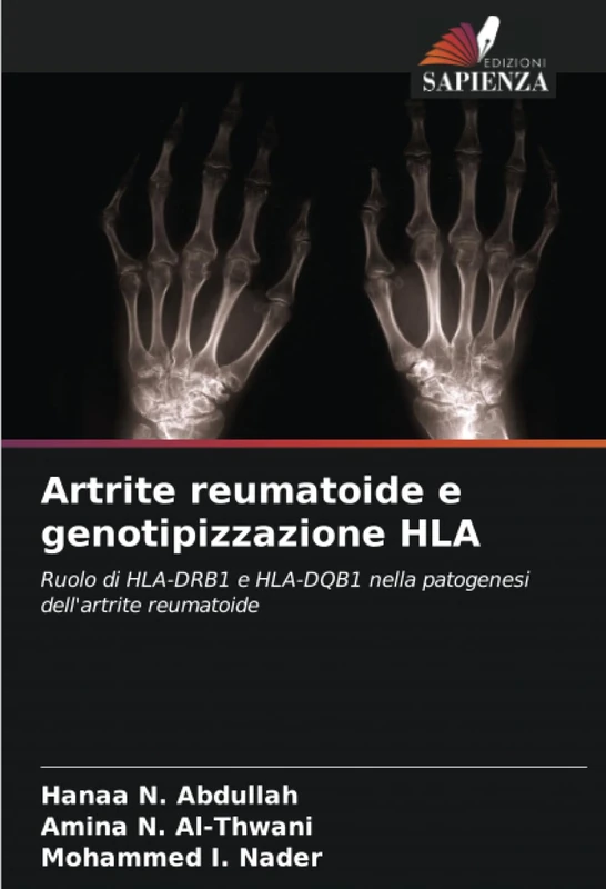 Artrite reumatoide e genotipizzazione HLA: Ruolo di HLA-DRB1 e HLA-DQB1 nella patogenesi dell'artrite reumatoide