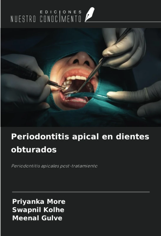 Periodontitis apical en dientes obturados: Periodontitis apicales post-tratamiento - Image 1