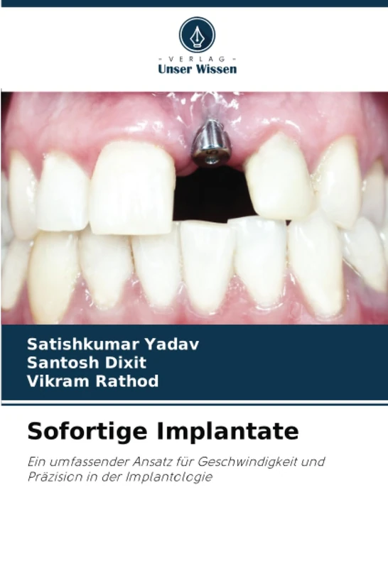 Sofortige Implantate: Ein umfassender Ansatz für Geschwindigkeit und Präzision in der Implantologie