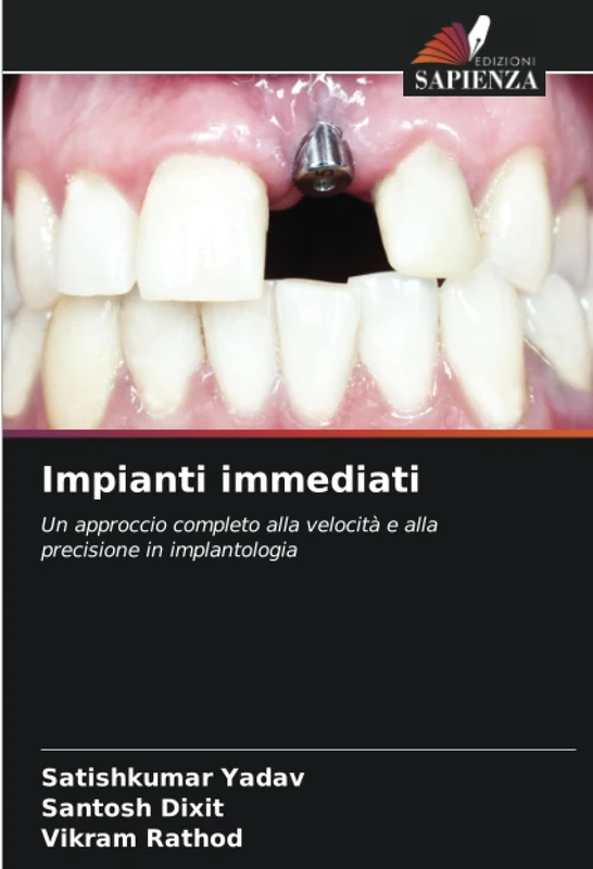 Impianti immediati: Un approccio completo alla velocità e alla precisione in implantologia