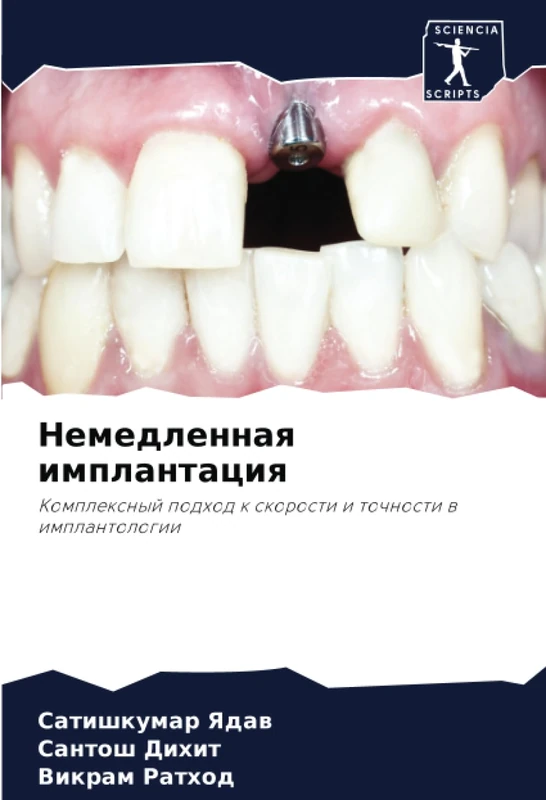 Немедленная имплантация: Комплексный подход к скорости и точности в имплантологии: Komplexnyj podhod k skorosti i tochnosti w implantologii - Image 1