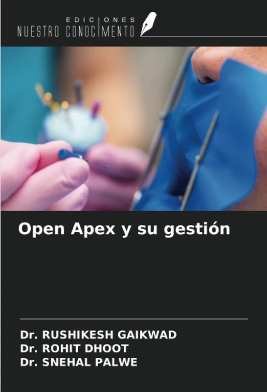 Open Apex y su gestión - Image 1