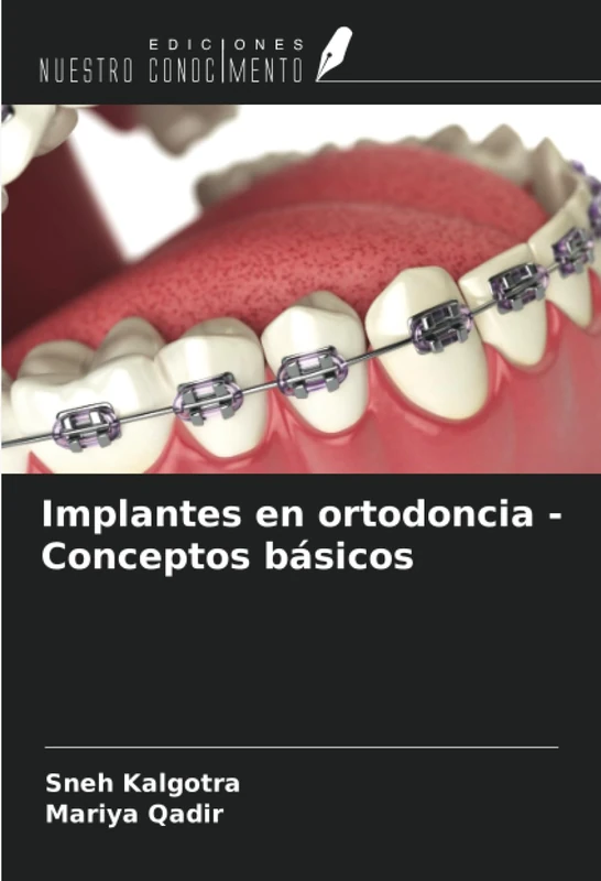 Implantes en ortodoncia - Conceptos básicos